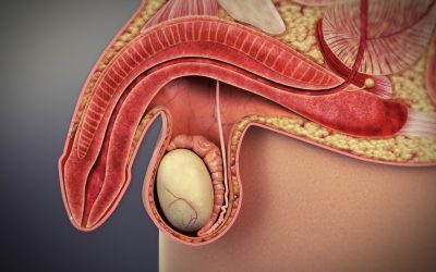 TREATMENT FOR AN ENLARGED PROSTATE IN NIGERIA