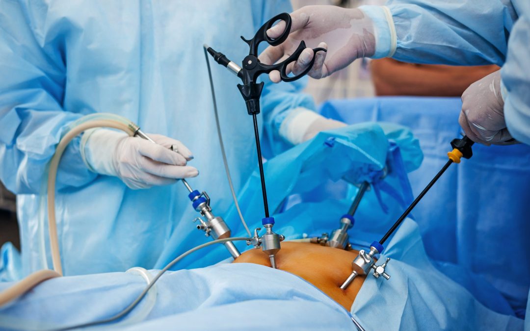 LAPAROSCOPIC SURGERY IN NIGERIA