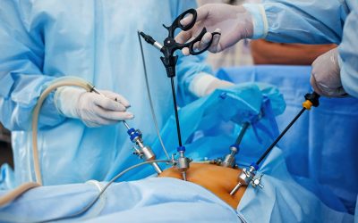 LAPAROSCOPIC SURGERY IN NIGERIA